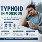 Typhoid Symptoms during Monsoon
