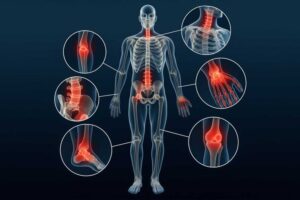 arthritis